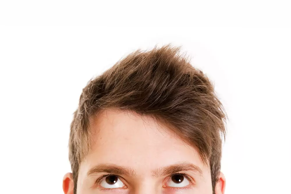 Saç ekimi greft nedir