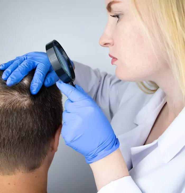 Saç ekimi saç ne zaman çıkar